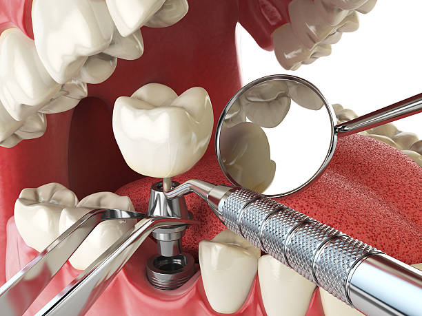 Best Tooth Infection Emergency Dentist  in Rockville, MN